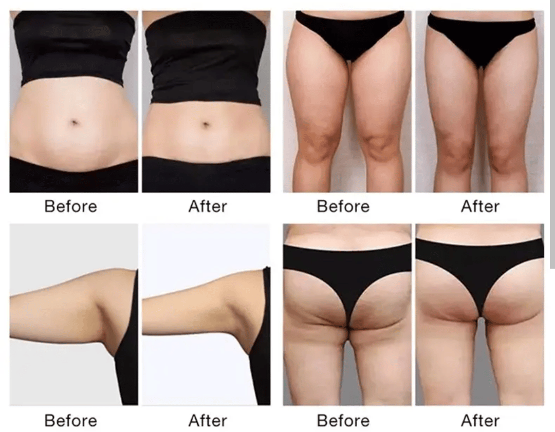 Elevation Body Boost portfolio 1