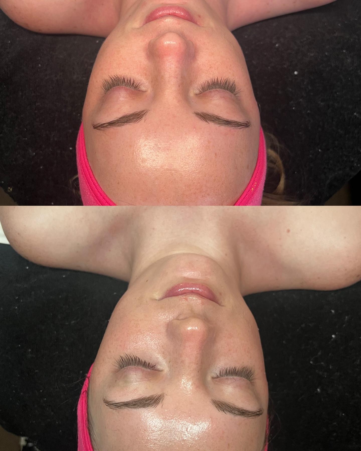 Scottsdale Skin Bar portfolio 5